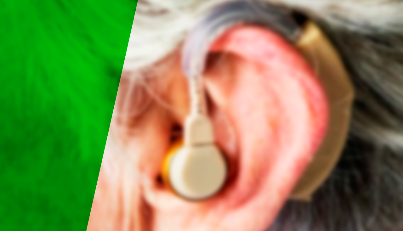 aparelho auditivo otoclinic 3